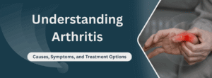 Understanding Arthritis: Causes, Symptoms, and Treatment